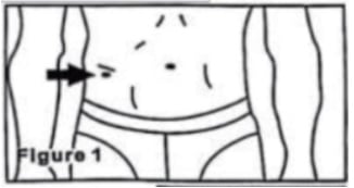 kaliper za merenje masti - slika 1