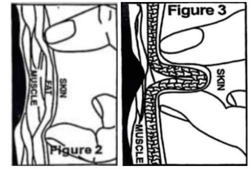 slike 2 i 3 - kaliper